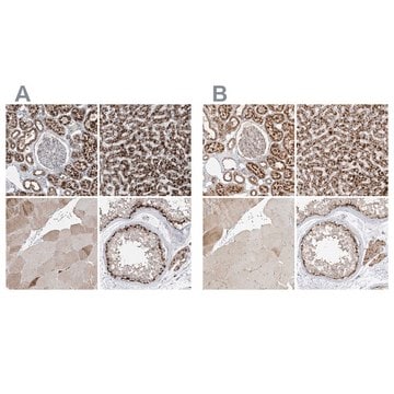 Anti-ABCD3 antibody produced in rabbit Prestige Antibodies&#174; Powered by Atlas Antibodies, affinity isolated antibody, buffered aqueous glycerol solution