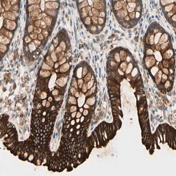 Anti-SKIL antibody produced in rabbit Prestige Antibodies&#174; Powered by Atlas Antibodies, affinity isolated antibody, buffered aqueous glycerol solution