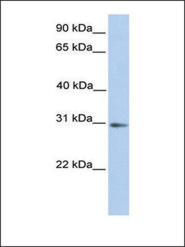 Anti-ABHD13 (AB1) antibody produced in rabbit affinity isolated antibody