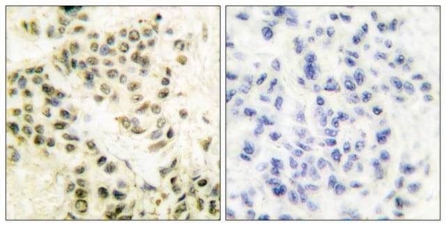 Anti-DNA-PK antibody produced in rabbit affinity isolated antibody