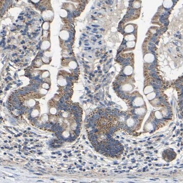 Anti-INTS6L antibody produced in rabbit Prestige Antibodies&#174; Powered by Atlas Antibodies, affinity isolated antibody, buffered aqueous glycerol solution