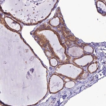 Anti-RNF126 antibody produced in rabbit Prestige Antibodies&#174; Powered by Atlas Antibodies, affinity isolated antibody, buffered aqueous glycerol solution