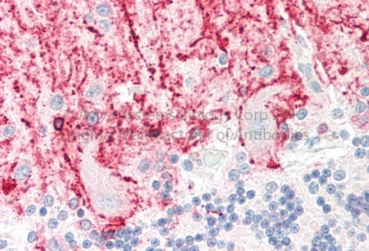 Anti-RCAN1 (N-terminal) antibody produced in rabbit affinity isolated antibody