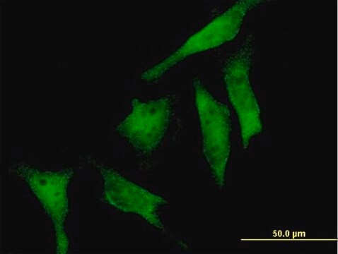 Anti-RIOK2 antibody produced in mouse purified immunoglobulin, buffered aqueous solution