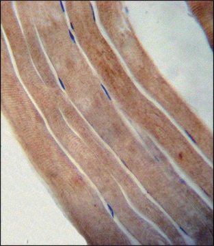 ANTI-EFTUD1 (C-TERM) antibody produced in rabbit IgG fraction of antiserum, buffered aqueous solution