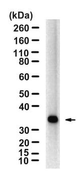 Anti-EBAG9 Antibody, clone 1N15 ZooMAb&#174; Rabbit Monoclonal recombinant, expressed in HEK 293 cells