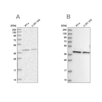 Anti-PSMD13 antibody produced in rabbit Prestige Antibodies&#174; Powered by Atlas Antibodies, affinity isolated antibody, buffered aqueous glycerol solution