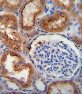 ANTI-SLC5A12 (C-TERM) antibody produced in rabbit IgG fraction of antiserum, buffered aqueous solution