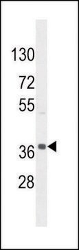 ANTI-NKAPL (C-TERM) antibody produced in rabbit IgG fraction of antiserum, buffered aqueous solution