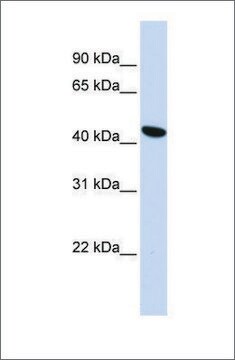 Anti-TMEM117 antibody produced in rabbit affinity isolated antibody