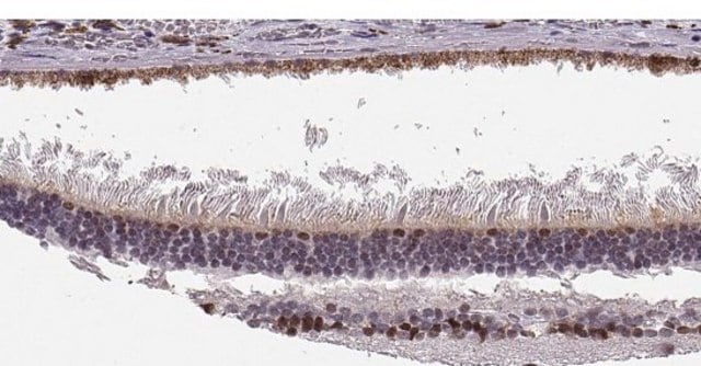 Anti-SIX6 antibody produced in rabbit Prestige Antibodies&#174; Powered by Atlas Antibodies, affinity isolated antibody, buffered aqueous glycerol solution