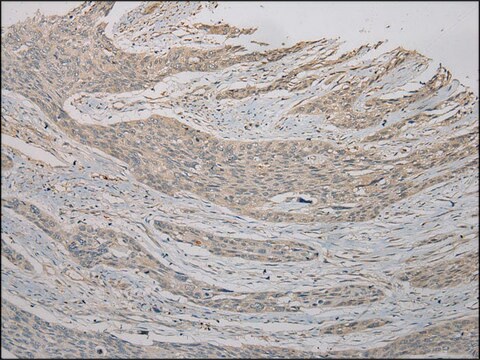 Anti-TSPY1/TSPY3 affinity isolated antibody