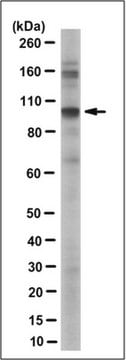 Anti-PTPN22 Antibody, clone 3B3.1 culture supernatant, clone 3B3.1, from mouse