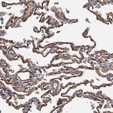 Anti-DGKG antibody produced in rabbit Prestige Antibodies&#174; Powered by Atlas Antibodies, affinity isolated antibody, buffered aqueous glycerol solution