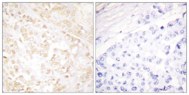 Anti-XRCC6 antibody produced in rabbit affinity isolated antibody