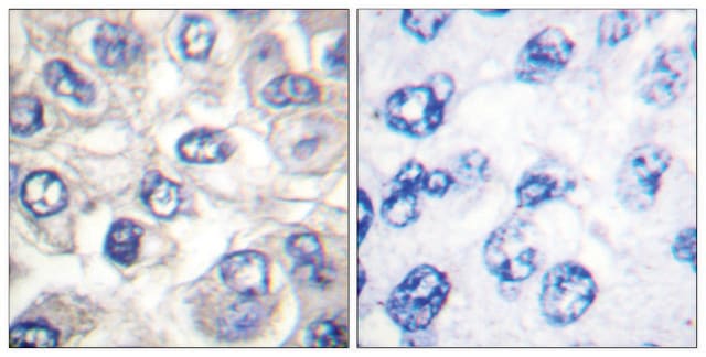 Anti-BAD (Cleaved-Asp71) antibody produced in rabbit affinity isolated antibody