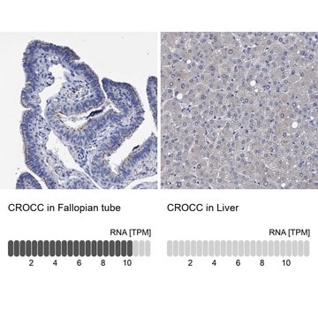 Anti-CROCC antibody produced in rabbit Prestige Antibodies&#174; Powered by Atlas Antibodies, affinity isolated antibody, buffered aqueous glycerol solution, Ab2