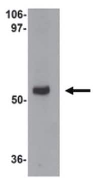 Anti-MYOZAP Antibody from rabbit, purified by affinity chromatography