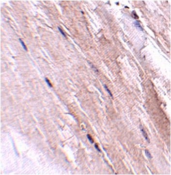 Anti-NIPSNAP2 Antibody from rabbit, purified by affinity chromatography