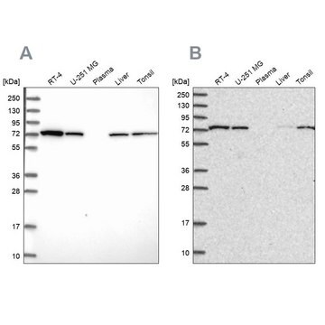 Anti-SNX1 antibody produced in rabbit Prestige Antibodies&#174; Powered by Atlas Antibodies, affinity isolated antibody, buffered aqueous glycerol solution