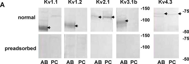 Anticuerpo anti-canal de potasio Kv3.1b Chemicon&#174;, from rabbit