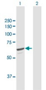 Anti-SQLE antibody produced in mouse purified immunoglobulin, buffered aqueous solution