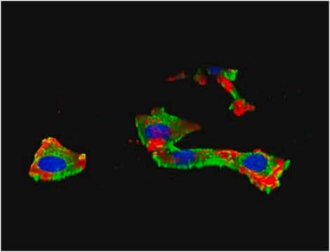 Anti-IGF-IR&#945; subunit Antibody from chicken, purified by affinity chromatography