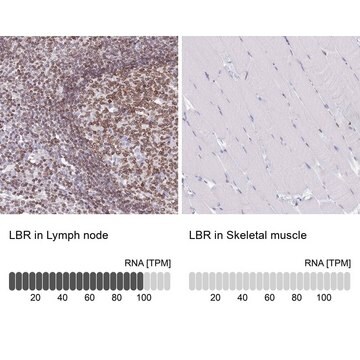 Anti-LBR antibody produced in rabbit Prestige Antibodies&#174; Powered by Atlas Antibodies, affinity isolated antibody, buffered aqueous glycerol solution