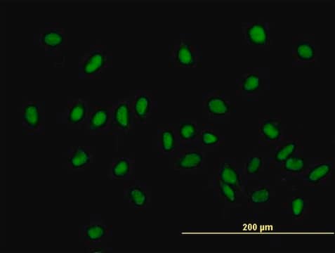 ANTI-ZHX1 antibody produced in mouse purified immunoglobulin, buffered aqueous solution