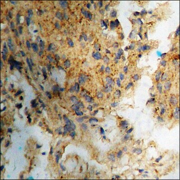 Anti-phospho-HSF1 (pSer121) antibody produced in rabbit affinity isolated antibody