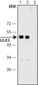 Anti-ULK3 antibody produced in rabbit ~1&#160;mg/mL, affinity isolated antibody