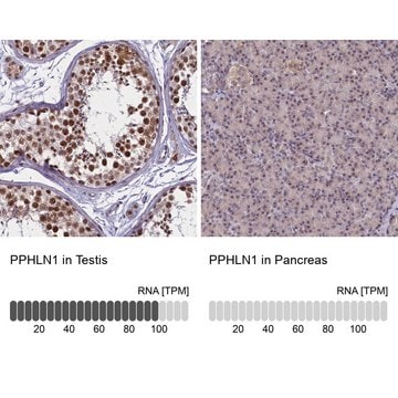 Anti-PPHLN1 antibody produced in rabbit Prestige Antibodies&#174; Powered by Atlas Antibodies, affinity isolated antibody, buffered aqueous glycerol solution