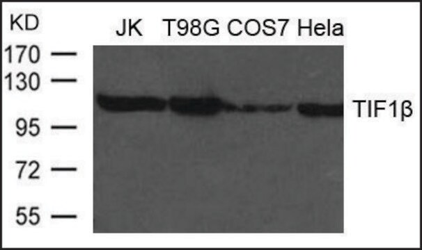 Anti-TIF1&#946; antibody produced in rabbit affinity isolated antibody