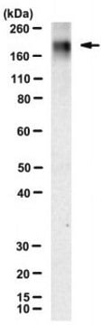 Anti-Laminin &#946;1 Antibody, clone 3E5