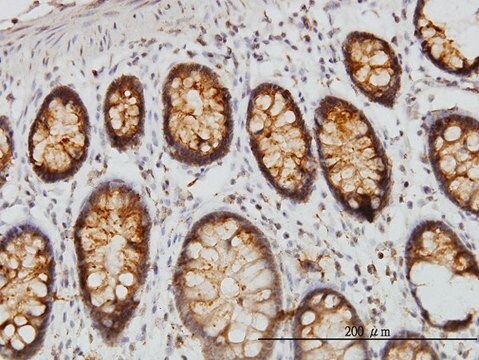 Monoclonal Anti-DARS antibody produced in mouse clone 2F11, purified immunoglobulin, buffered aqueous solution