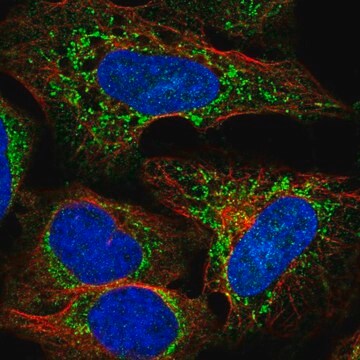 Anti-SLC25A27 antibody produced in rabbit Prestige Antibodies&#174; Powered by Atlas Antibodies, affinity isolated antibody