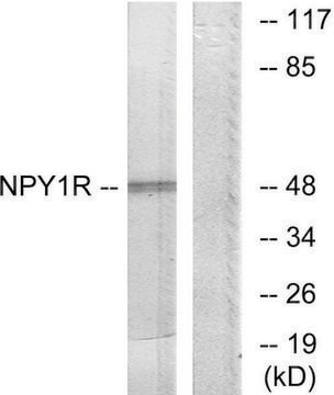 Anti-NPY1R antibody produced in rabbit affinity isolated antibody