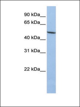 Anti-LOXL1 antibody produced in rabbit affinity isolated antibody