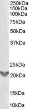 Anti-TGIF2 antibody produced in goat affinity isolated antibody, buffered aqueous solution