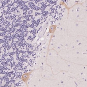 Anti-PNLIPRP3 antibody produced in rabbit Prestige Antibodies&#174; Powered by Atlas Antibodies, affinity isolated antibody, buffered aqueous glycerol solution