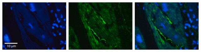 Anti-RB1CC1 antibody produced in rabbit affinity isolated antibody