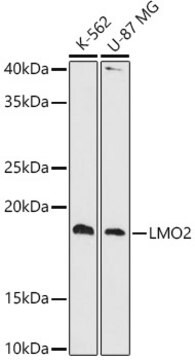 Anti-LMO2 Antibody, clone 9O5X9, Rabbit Monoclonal