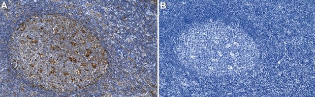 Anti-IL-13 Antibody, clone 1B10 ZooMAb&#174; Rabbit Monoclonal recombinant, expressed in HEK 293 cells