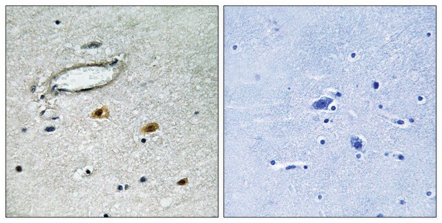 Anti-HSP27 antibody produced in rabbit affinity isolated antibody