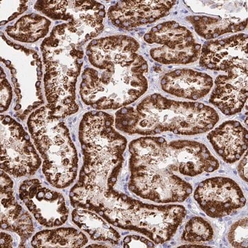 Anti-FAM160A2 antibody produced in rabbit Prestige Antibodies&#174; Powered by Atlas Antibodies, affinity isolated antibody, buffered aqueous glycerol solution