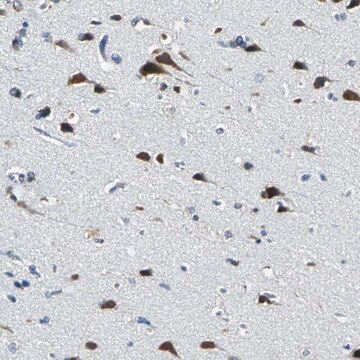 Anti-ZNF415 antibody produced in rabbit Prestige Antibodies&#174; Powered by Atlas Antibodies, affinity isolated antibody, buffered aqueous glycerol solution