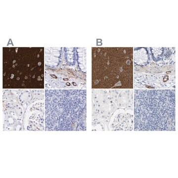 抗AMPH抗体 ウサギ宿主抗体 Prestige Antibodies&#174; Powered by Atlas Antibodies, affinity isolated antibody, buffered aqueous glycerol solution, Ab2