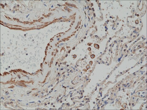 Anti-Matrix metalloproteinase-12 (MMP-12) antibody, Rabbit monoclonal recombinant, expressed in HEK 293 cells, clone RM381, purified immunoglobulin