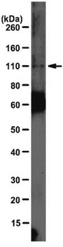 Anti-IGHMBP2 Antibody, clone11-24 clone mAb11-24, from mouse