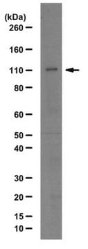 Anti-Lysine-specific demethylase 7 Antibody from rabbit, purified by affinity chromatography